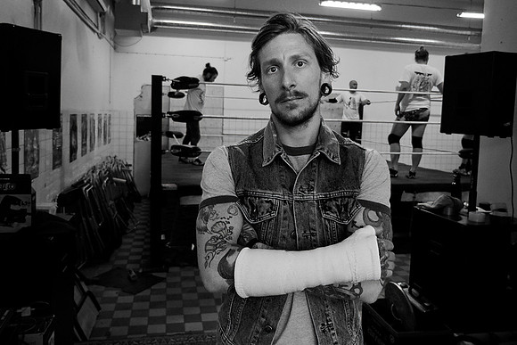 Injuries